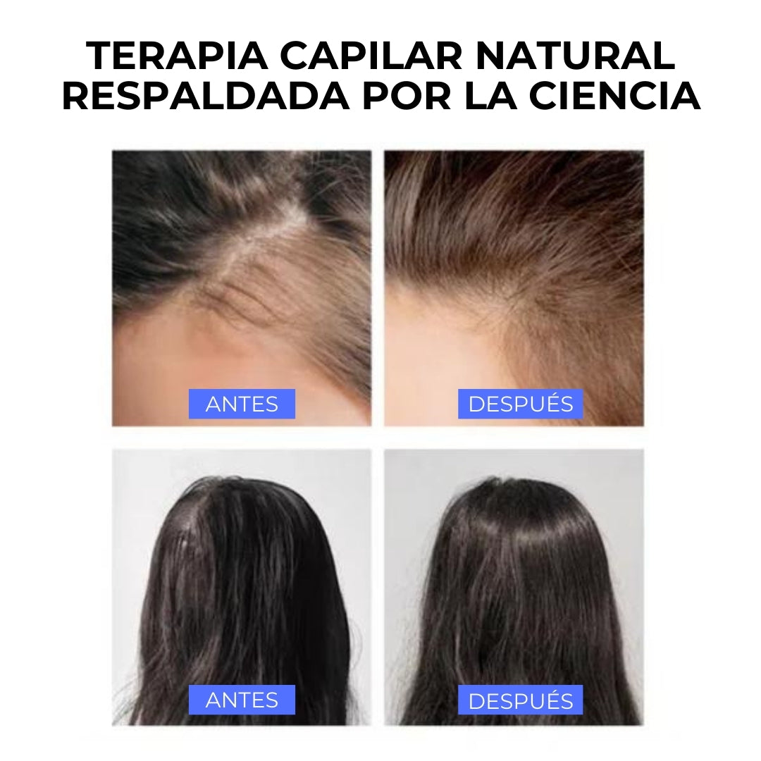 Health Brush - Peine de terapia
