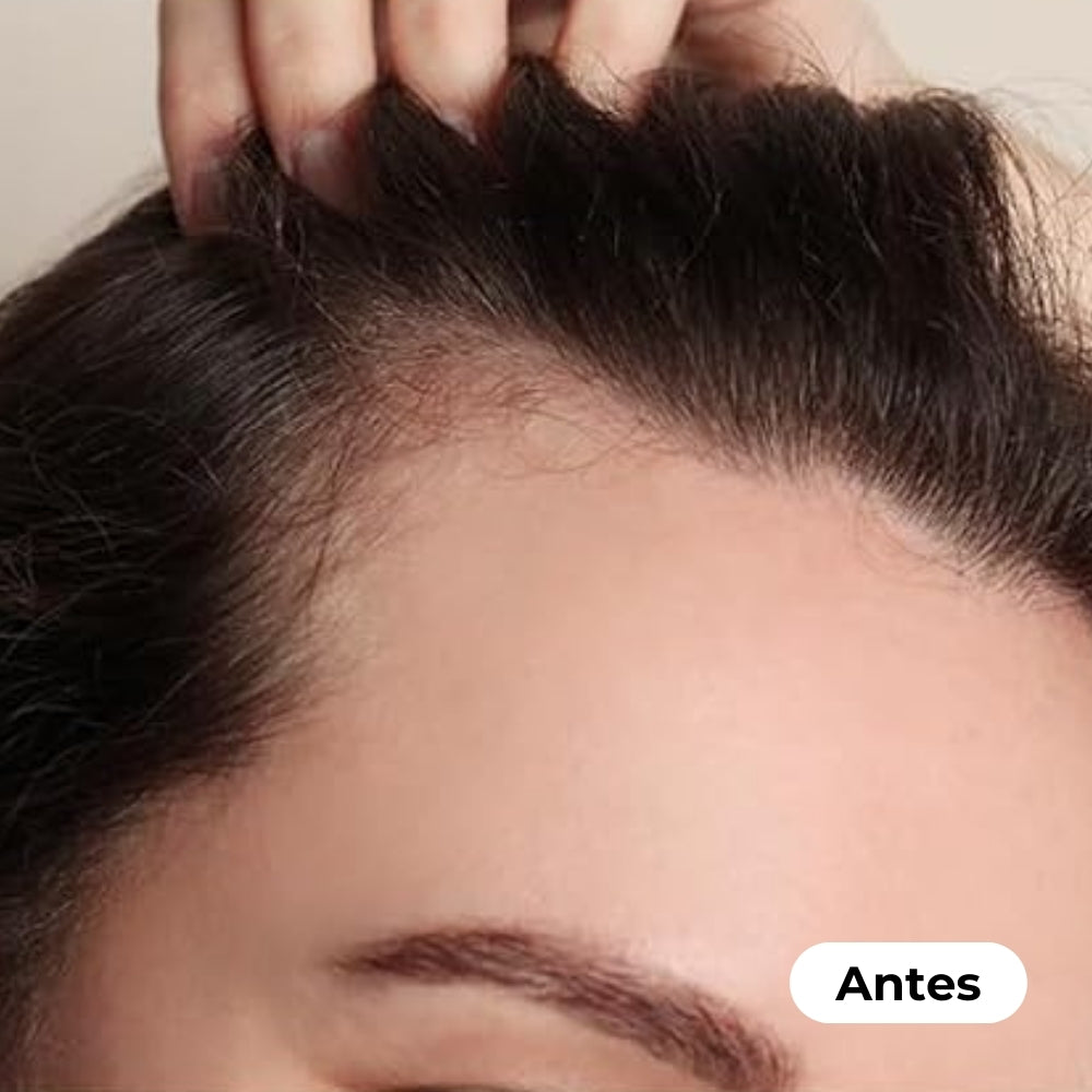 Veganic - Aceite para el Crecimiento del Cabello 100% Natural